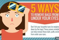 5 Proven Ways to Reduce Under-Eye Bags Quickly